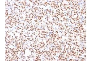 Image no. 2 for anti-Paired Box 8 (PAX8) (AA 60-261) antibody (ABIN4949848)