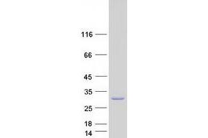 Image no. 1 for B-Cell Receptor-Associated Protein 31 (BCAP31) (Transcript Variant 3) protein (Myc-DYKDDDDK Tag) (ABIN2715173)