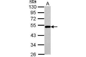 Image no. 1 for anti-Bleomycin Hydrolase (BLMH) (Center) antibody (ABIN2854416)