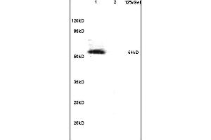 Image no. 1 for anti-Interferon Regulatory Factor 7 (IRF7) (pSer471), (pSer472) antibody (ABIN742703)