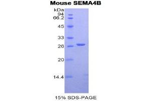 Image no. 1 for Sema Domain, Immunoglobulin Domain (Ig), Transmembrane Domain (TM) and Short Cytoplasmic Domain, (Semaphorin) 4B (SEMA4B) (AA 31-240) protein (His tag) (ABIN1877926)