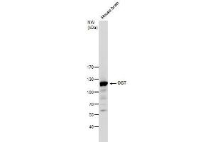 Image no. 6 for anti-O-Linked N-Acetylglucosamine (GlcNAc) Transferase (UDP-N-Acetylglucosamine:polypeptide-N-Acetylglucosaminyl Transferase) (OGT) (Center) antibody (ABIN2856718)