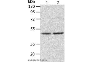 Image no. 2 for anti-Alanine Glyoxylate Aminotransferase (AGXT) antibody (ABIN2426537)