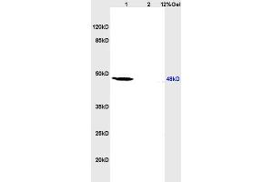 Image no. 3 for anti-Retinoic Acid Receptor, beta (RARB) (AA 155-250) antibody (ABIN669516)