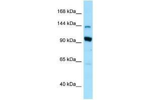 Image no. 1 for anti-USO1 Homolog, Vesicle Docking Protein (USO1) (N-Term) antibody (ABIN2789891)