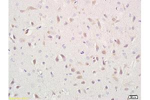 Image no. 1 for anti-L1 Cell Adhesion Molecule (L1CAM) (AA 1101-1257) antibody (ABIN676463)