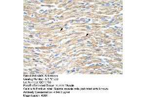 Image no. 4 for anti-LIM Homeobox Transcription Factor 1, alpha (LMX1A) (Middle Region) antibody (ABIN2779408)