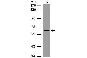 Image no. 5 for anti-Eukaryotic Translation Initiation Factor 3, Subunit D (EIF3D) (Center) antibody (ABIN2855038)