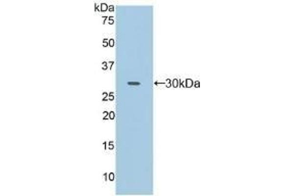 Fc gamma RII (CD32) (AA 69-309) antibody