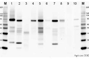 Image no. 2 for anti-ATPase, H+ Transporting, Lysosomal 38kDa, V0 Subunit D2 (ATP6V0D2) antibody (ABIN349654)