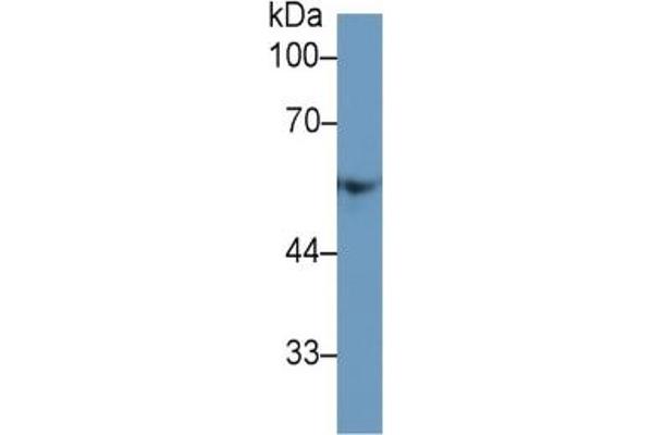 Fibrinogen beta Chain ELISA Kit