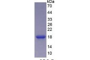 Image no. 2 for Carcinoembryonic Antigen Gene Family (CEA) ELISA Kit (ABIN6730886)