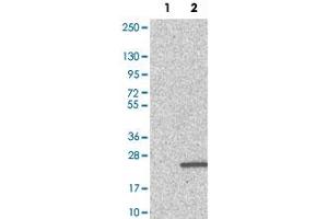 Image no. 1 for anti-Prefoldin Subunit 4 (PFDN4) antibody (ABIN5774649)