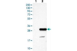 Image no. 2 for anti-Nuclear Transport Factor 2-Like Export Factor 2 (NXT2) antibody (ABIN5584878)