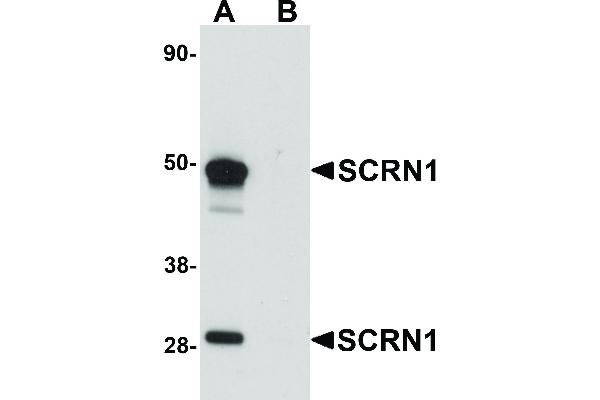 anti-Secernin 1 (SCRN1) (C-Term) antibody