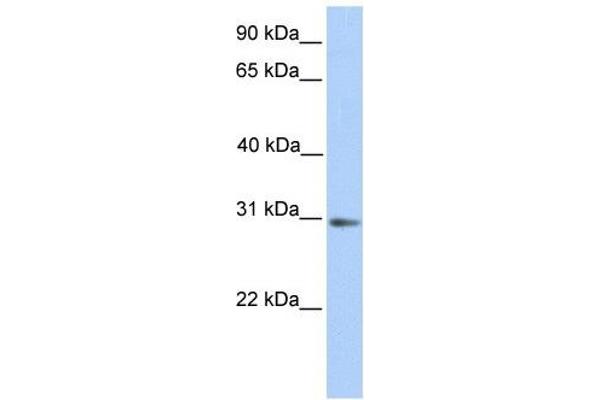 anti-Abhydrolase Domain Containing 13 (ABHD13) (N-Term) antibody