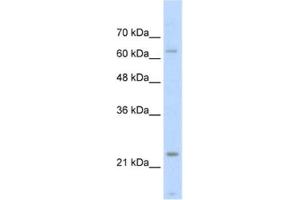 Image no. 1 for anti-Slow Skeletal Troponin I (TNNI1) antibody (ABIN2462531)