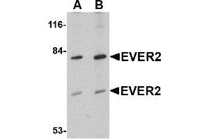 Western Blotting (WB) image for anti-Transmembrane Channel-Like 8 (TMC8) (Middle Region) antibody (ABIN1030928)
