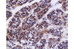 Image no. 2 for anti-Angiotensin I Converting Enzyme (Peptidyl-Dipeptidase A) 1 (ACE) (AA 31-130) antibody (ABIN2173528)
