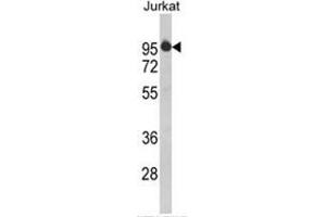 Image no. 1 for anti-HIV-1 Tat Specific Factor 1 (HTATSF1) (N-Term) antibody (ABIN453121)