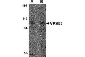 Image no. 1 for anti-Vacuolar Protein Sorting 53 Homolog (VPS53) (Middle Region) antibody (ABIN1031162)
