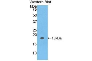 Image no. 1 for anti-Carcinoembryonic Antigen Gene Family (CEA) antibody (Biotin) (ABIN1172455)