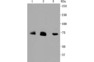 Image no. 1 for anti-Aminolevulinate, delta-, Synthase 1 (ALAS1) antibody (ABIN5557346)