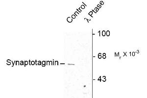 Image no. 1 for anti-Synaptotagmin I (SYT1) (pSer309) antibody (ABIN361497)