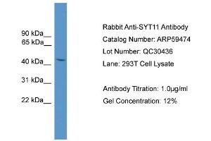 Image no. 2 for anti-Synaptotagmin XI (SYT11) (N-Term) antibody (ABIN2788083)