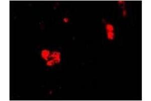 Image no. 1 for anti-Cell Death-Inducing DFFA-Like Effector B (CIDEB) (C-Term) antibody (ABIN499631)
