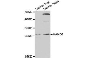 Image no. 1 for anti-Heart and Neural Crest Derivatives Expressed 2 (HAND2) antibody (ABIN2562997)