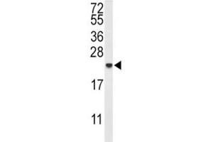 Image no. 3 for anti-Interleukin 10 (IL10) (AA 27-53) antibody (ABIN3031441)