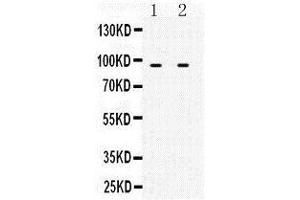 MCM3 Antikörper  (N-Term)