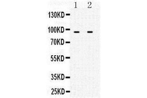 MCM3 anticorps  (N-Term)