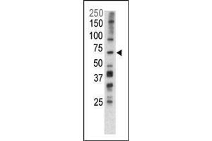 Image no. 1 for anti-PTEN Induced Putative Kinase 1 (PINK1) (AA 237-266) antibody (ABIN1882117)