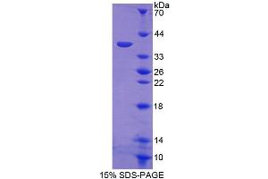 Image no. 1 for Protein Phosphatase 6, Catalytic Subunit (PPP6C) (AA 3-305) protein (His tag) (ABIN6239542)