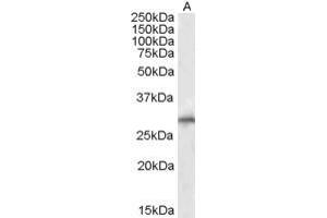 SIAH1 antibody  (N-Term)