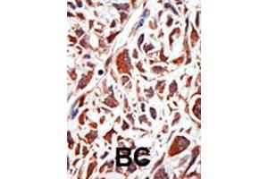 Image no. 2 for anti-BMI1 Polycomb Ring Finger Oncogene (BMI1) (AA 257-286), (C-Term) antibody (ABIN389084)