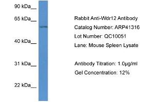 anti-WD Repeat Domain 12 (WDR12) (Middle Region) antibody