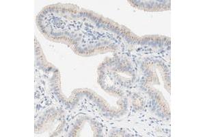 Image no. 2 for anti-Mannosidase, Endo-alpha (MANEA) antibody (ABIN5582956)