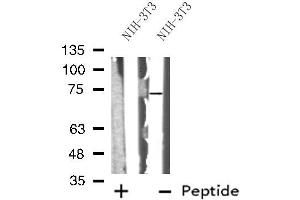 Image no. 1 for anti-ATP-Binding Cassette, Sub-Family G (WHITE), Member 5 (ABCG5) (Internal Region) antibody (ABIN6259695)