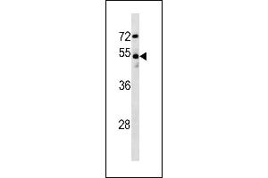 Image no. 1 for anti-Doublecortin-Like Kinase 1 (DCLK1) (AA 685-712) antibody (ABIN1881252)