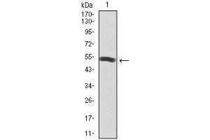 Image no. 5 for anti-Phosphoinositide 3 Kinase, p85 alpha (PI3K p85a) (AA 159-388) antibody (ABIN1098111)
