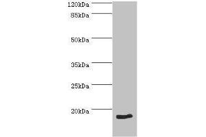 Image no. 3 for anti-Pro-Brain Natriuretic Peptide (NT-ProBNP) (NT-ProBNP) (AA 27-102) antibody (ABIN2917769)