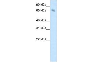 Image no. 1 for anti-Kelch-like protein 41 (KLHL41) (C-Term) antibody (ABIN2780741)