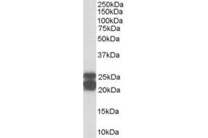 Image no. 7 for anti-Caveolin 1, Caveolae Protein, 22kDa (CAV1) (Internal Region) antibody (ABIN185421)
