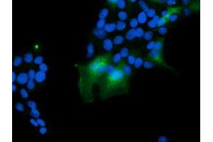 Image no. 4 for anti-Prefoldin Subunit 3 (PFDN3) antibody (ABIN1501700)