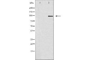 Image no. 1 for anti-Glutamate Receptor, Ionotropic, delta 1 (GRID1) antibody (ABIN6257602)