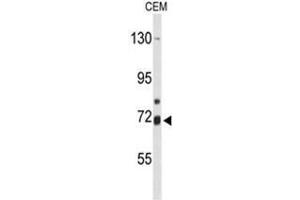 Image no. 2 for anti-Arachidonate 15-Lipoxygenase B (ALOX15B) (AA 605-634), (C-Term) antibody (ABIN950355)