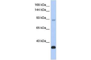 Image no. 2 for anti-B-Cell CLL/lymphoma 11B (Zinc Finger Protein) (BCL11B) (Middle Region) antibody (ABIN2777845)